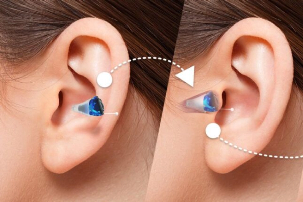 Invisible In the Canal (IIC) Hearing Aid